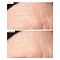 111SKIN Exosome Face Lift Treatment Set - интернет-магазин профессиональной косметики Spadream, изображение 74033